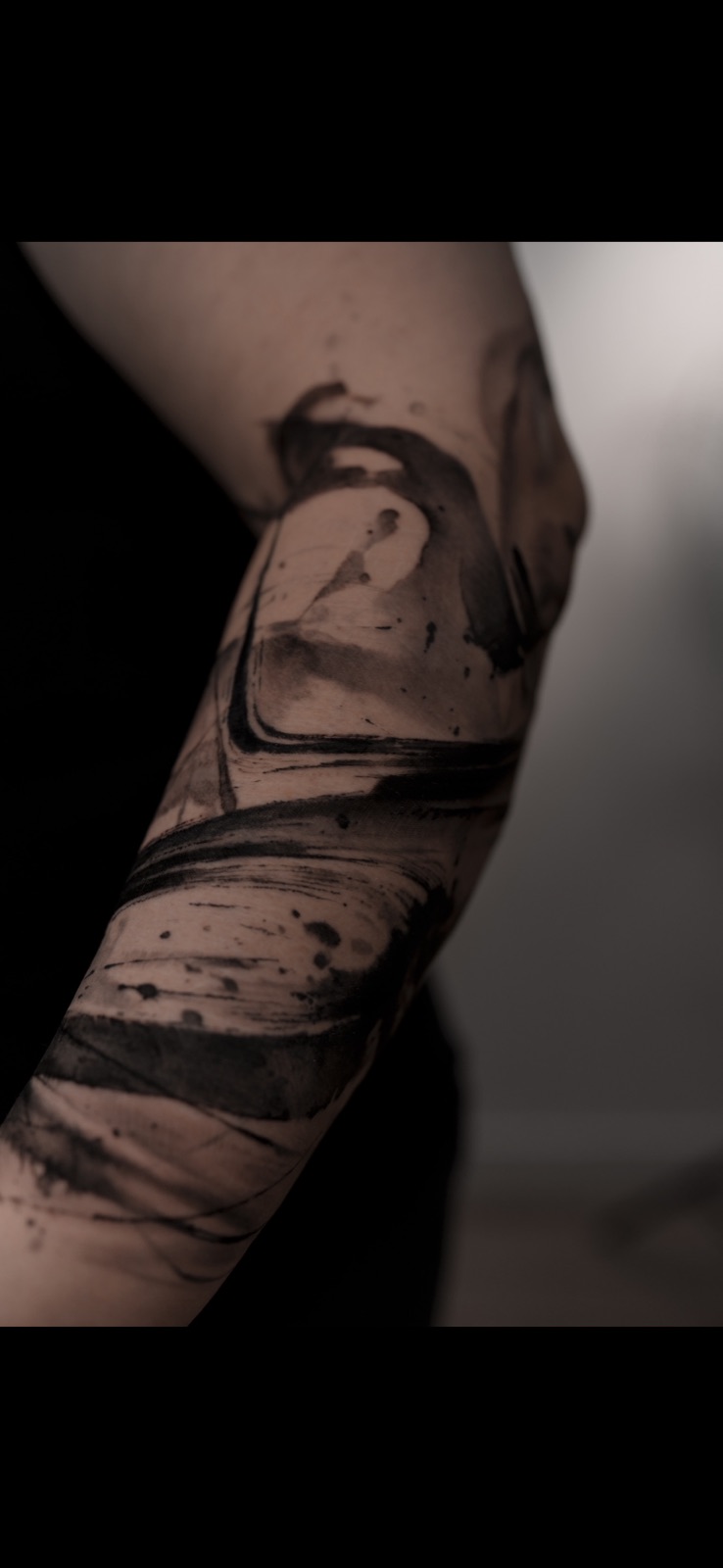 Forearm — Elbow Detail